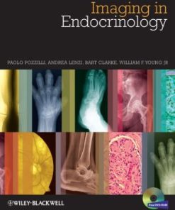 Atlas of Endocrine and Metabolic Disease
