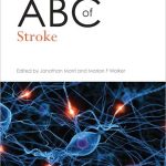 ABC of Stroke