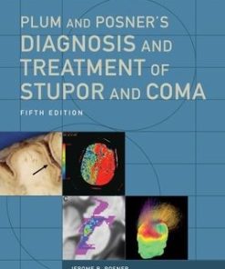 Plum and Posner's Diagnosis and Treatment of Stupor and Coma 5th Edition