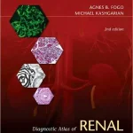 Diagnostic Atlas of Renal Pathology 2nd Edition