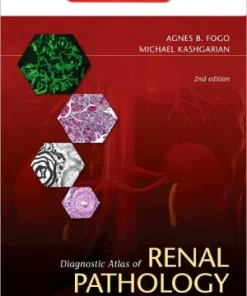 Diagnostic Atlas of Renal Pathology 2nd Edition