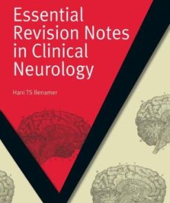 MasterPass Essential Revision Notes in Clinical Neurology