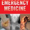 Emergency Medicine Cases
