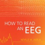 How to Read an EEG