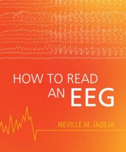 How to Read an EEG
