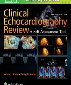 Clinical Echocardiography Review 2nd Edition