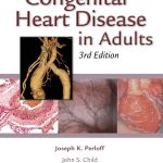 Congenital Heart Disease in Adults 3rd Edition