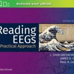 Reading EEGs A Practical Approach 2nd Edition