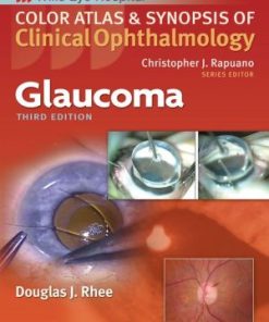 Color Atlas and Synopsis of Clinical Ophthalmology Glaucoma 3rd Edition