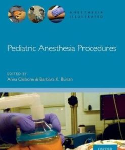 Pediatric Anesthesia Procedures