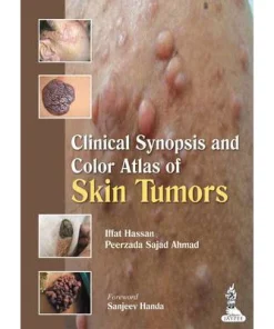 Clinical Synopsis and Color Atlas of Skin Tumors