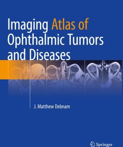 Imaging Atlas of Ophthalmic Tumors and Diseases