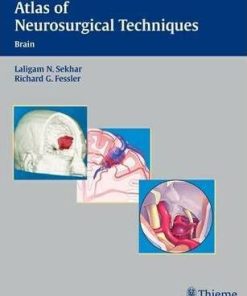 Atlas of Neurosurgical Techniques Brain
