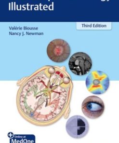 Neuro Ophthalmology Illustrated 3rd Edition