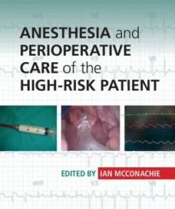 Anesthesia and Perioperative Care of the High Risk Patient