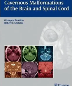 Cavernous Malformations of the Brain and Spinal Cord