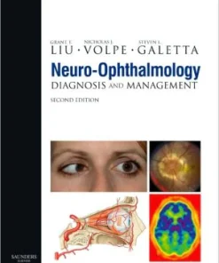 Neuro Ophthalmology 2nd Edition