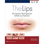 The Lips 45 Injection Techniques for Esthetic Lip Treatment