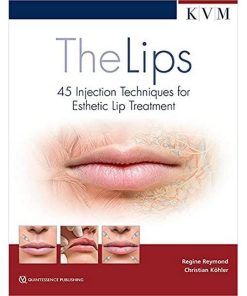 The Lips 45 Injection Techniques for Esthetic Lip Treatment