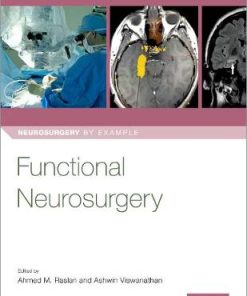 Functional Neurosurgery