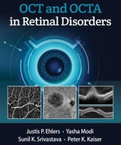 OCT and OCTA in Retinal Disorders