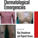 Dermatological Emergencies