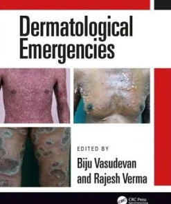 Dermatological Emergencies