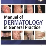 Manual of Dermatology in General Practice