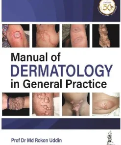 Manual of Dermatology in General Practice