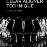 Clear Aligner Technique