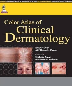 Color Atlas of Clinical Dermatology