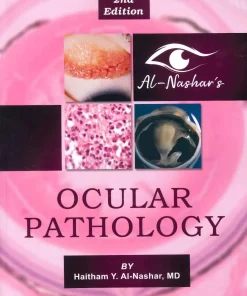 Al Nashar's Ocular Pathology 2nd Edition