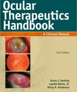 Ocular Therapeutics Handbook A Clinical Manual 3rd Edition