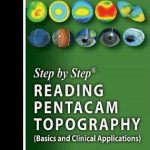 Step by Step Reading Pentacam Topography Basics and Clinical Applications 3rd Edition