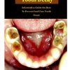 Remedies To Tooth Decay Remedies To Tooth Decay