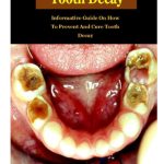 Remedies To Tooth Decay Remedies To Tooth Decay