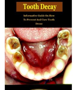 Remedies To Tooth Decay Remedies To Tooth Decay