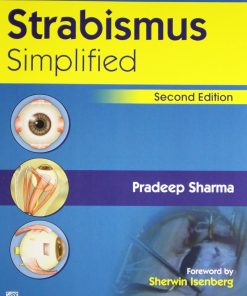 Strabismus Simplified 2nd Edition
