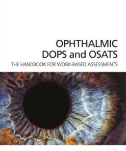 Ophthalmic DOPS and OSATS The Handbook for Work Based Assessments