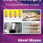 MCQs in Oral Surgery A comprehensive review