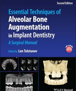 Essential Techniques of Alveolar Bone Augmentation in Implant Dentistry A Surgical Manual