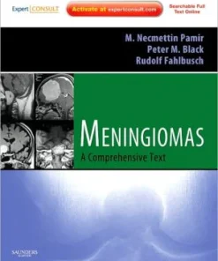 Meningiomas