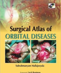 Surgical Atlas Surgical Atlas of Orbital Diseasesof Orbital Diseases