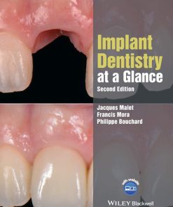 Implant Dentistry at a Glance