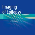 Imaging of Epilepsy A Clinical Atlas