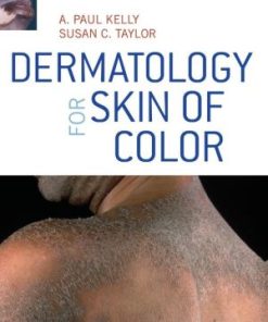 Dermatology for Skin of Color