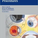 Ophthalmic Surgical Procedures 2nd Edition