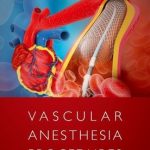 Vascular AneVascular Anesthesia Proceduressthesia Procedures