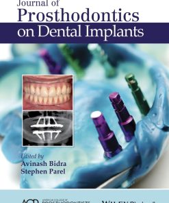 Journal of Prosthodontics on Dental Implants