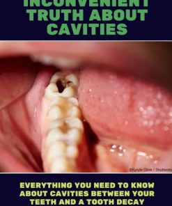 THE INCONVENIENT TRUTH ABOUT CAVITIES Everything You Need to Know About Cavities Between Your Teeth and a Tooth Decay